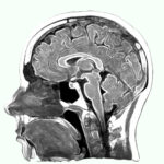 MRI-scans-brain