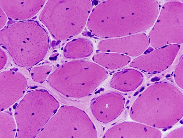 Muscle cell
