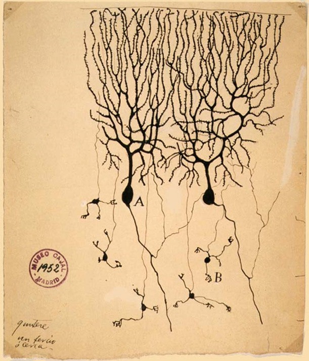neuro-pathology of purkinjecell