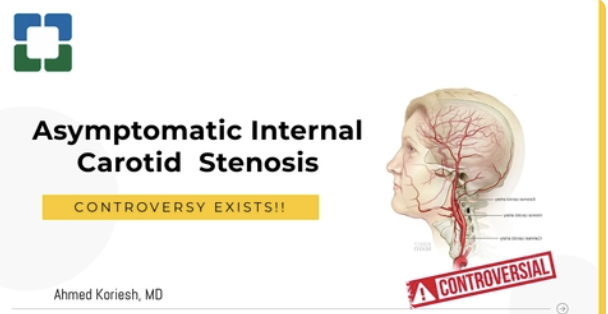Asymptomatic ICA stenosis